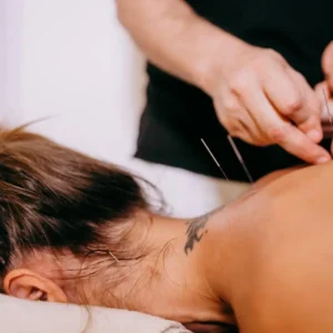 Can Acupuncture Help Your Mental Health? 6 Benefits & Helpful Research